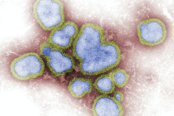 México enfrenta epidemia de sarampión con más de 10 mil casos confirmados