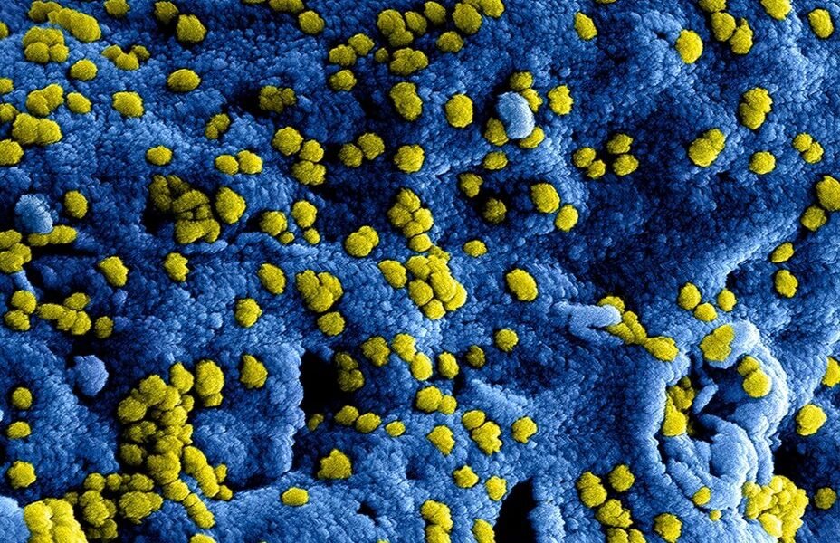 México enfrenta resurgimiento del sarampión con más de 10 mil casos confirmados