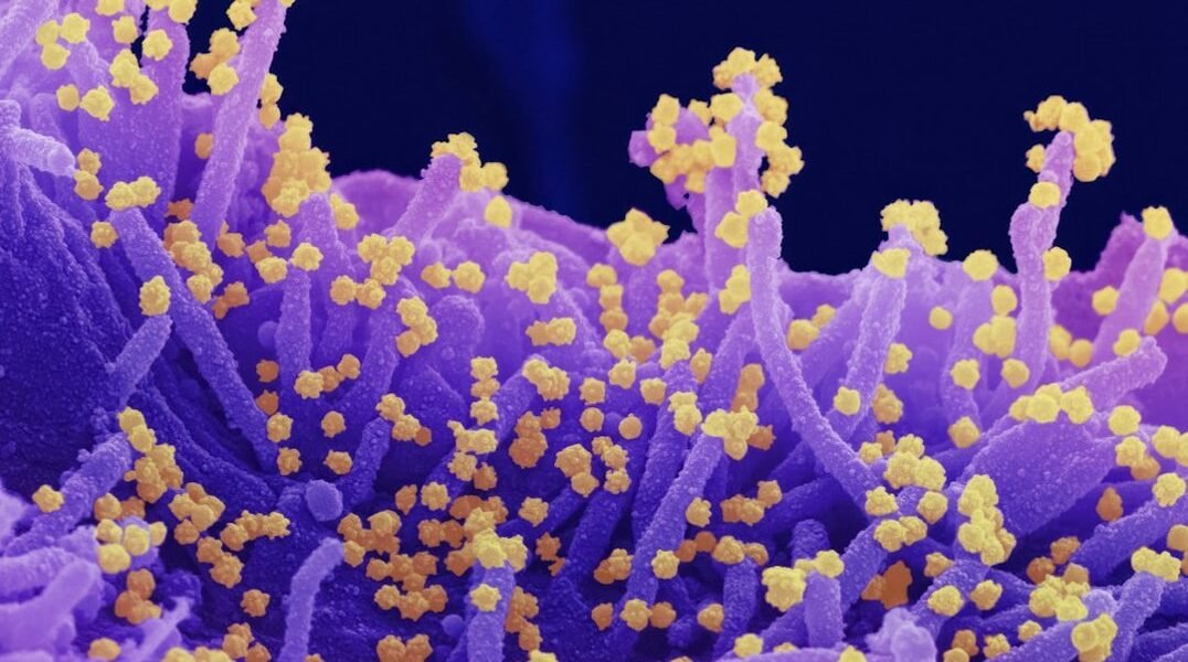 México enfrenta brote de sarampión con más de 10 mil casos confirmados