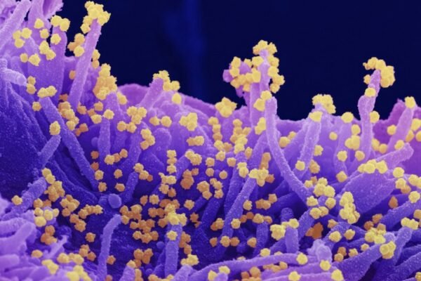 México enfrenta brote de sarampión con más de 10 mil casos confirmados