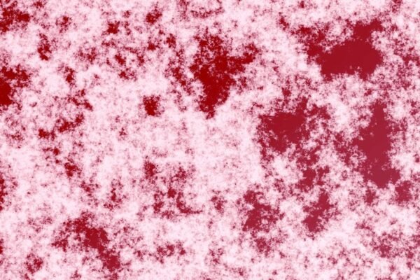 Sarampión en México: más de 6,700 casos en tres meses disparan alarma sanitaria