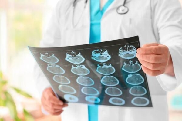 IMSS refuerza atención de encefalitis: qué es, síntomas y prevención