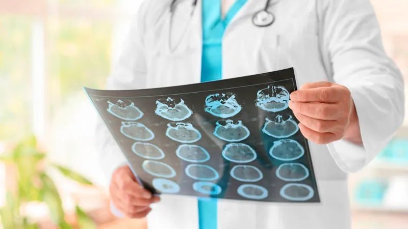 IMSS refuerza atención de encefalitis: qué es, síntomas y prevención