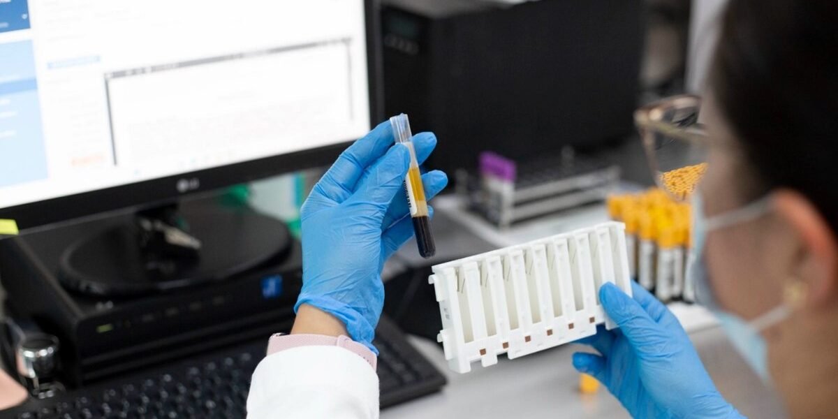 ISSEMYM realiza 48 mil pruebas mensuales con tecnología de precisión oncológica