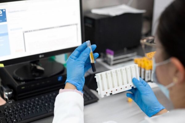 ISSEMYM realiza 48 mil pruebas mensuales con tecnología de precisión oncológica