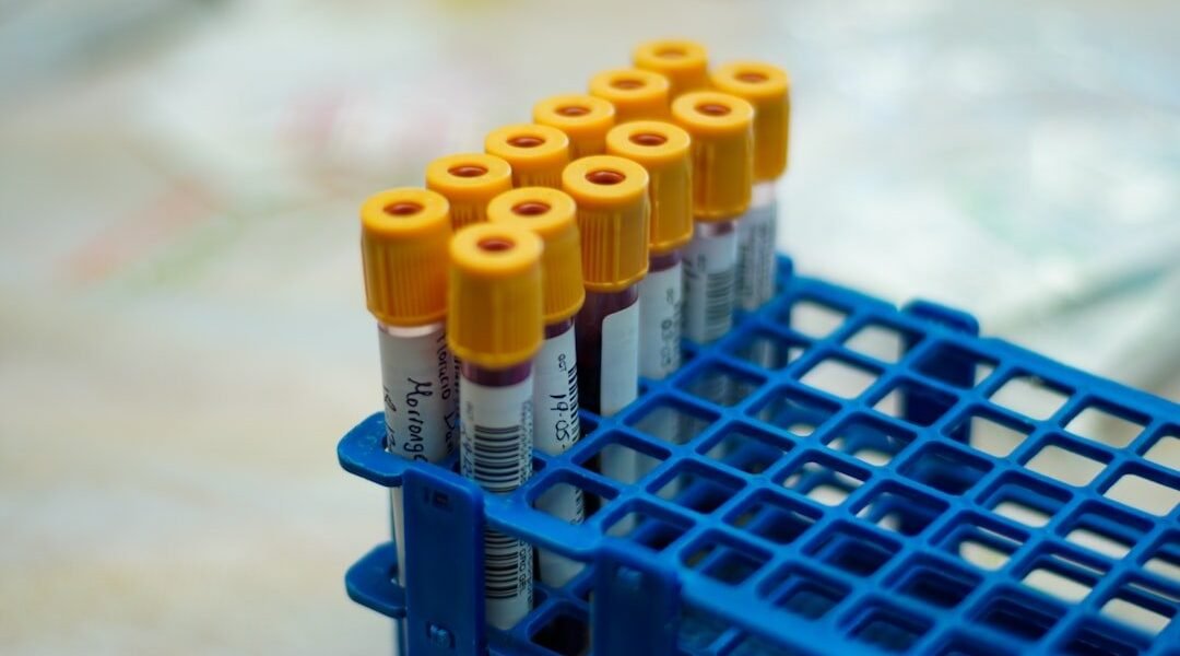 México refuerza vigilancia ante amenaza de ébola y hantavirus