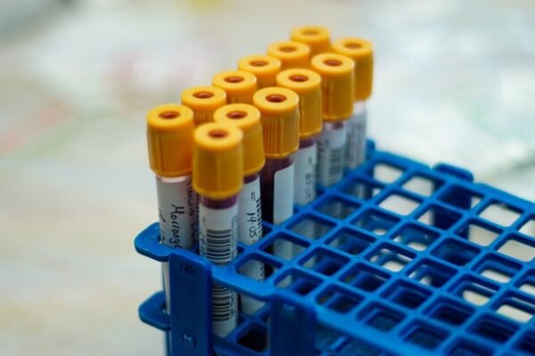 México refuerza vigilancia ante amenaza de ébola y hantavirus