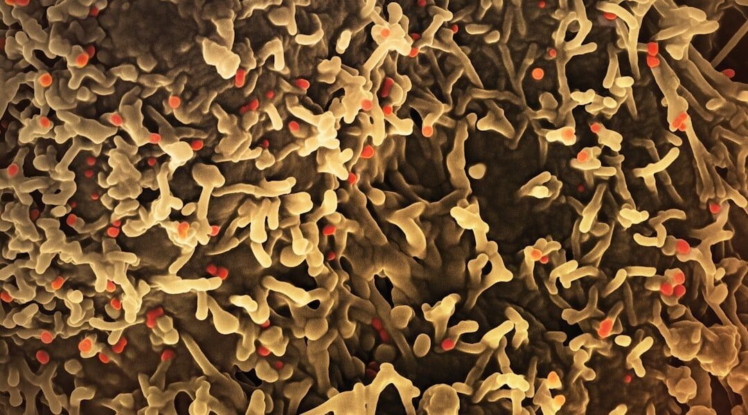 México mantiene vigilancia ante casos de Cyclospora mientras EE.UU. registra aumentos
