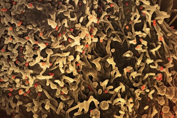 México mantiene vigilancia ante casos de Cyclospora mientras EE.UU. registra aumentos