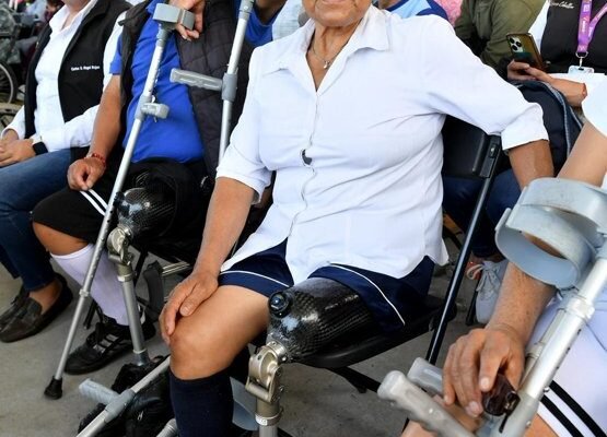 Estado de México entrega 103 prótesis a personas con discapacidad